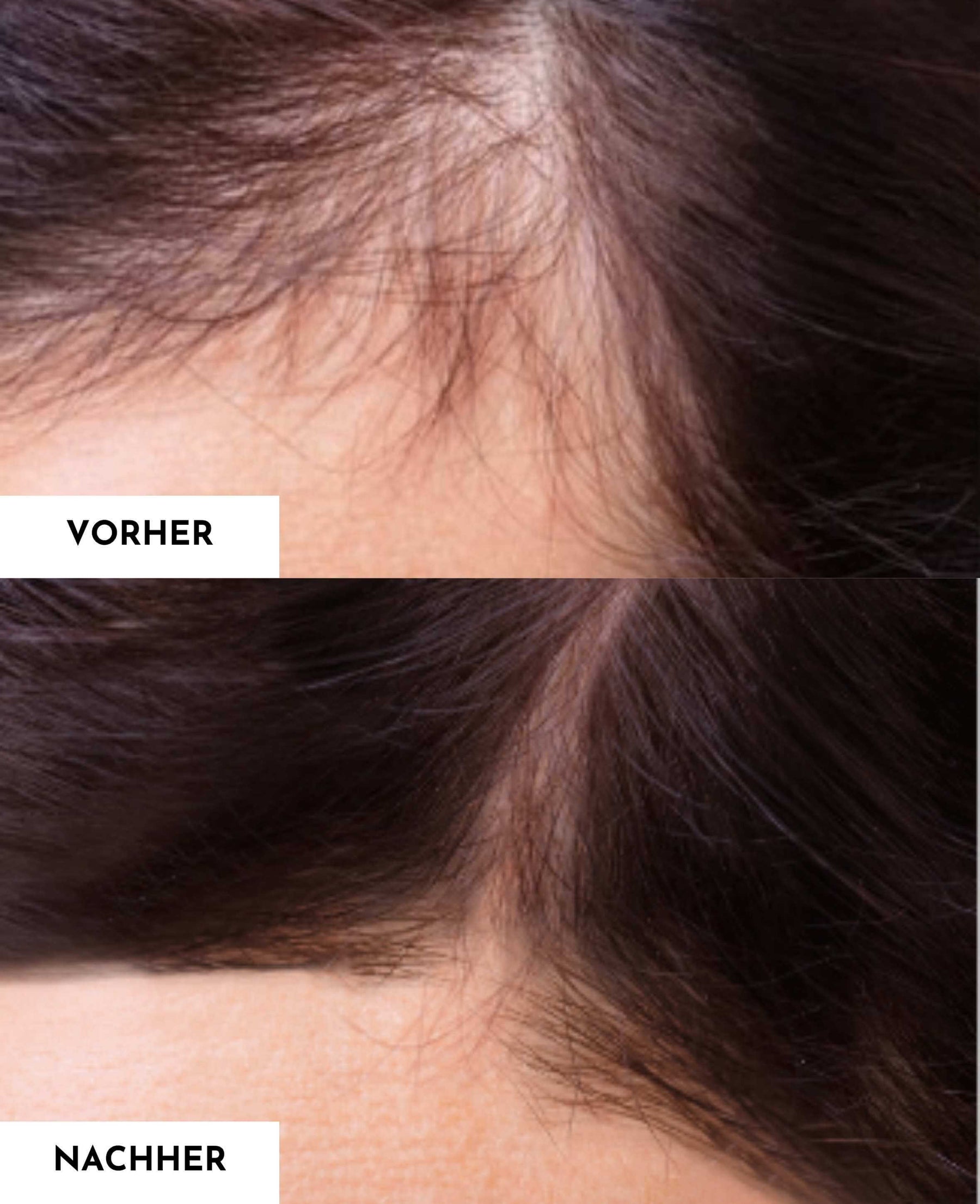 Sérum booster de cheveux